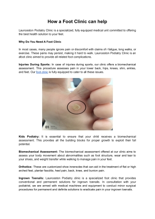 How a Foot Clinic can help