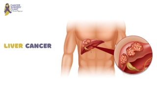 Best Liver Cancer Treatment Doctor in Mumbai