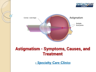 Astigmatism - Symptoms, Causes, and Treatment
