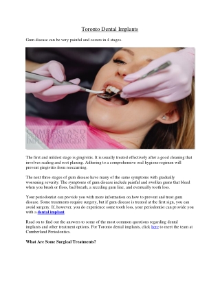 Toronto Dental Implants