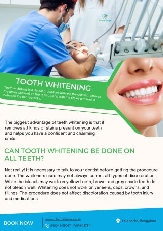 Can Tooth Whitening Done on All Teeth - Dental Clinic in Yelahanka - Dental Sage