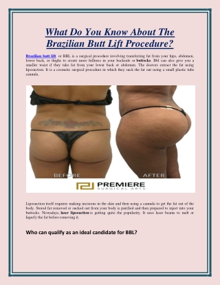 What Do You Know About The Brazilian Butt Lift Procedure