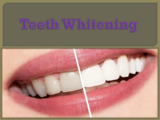 Teeth Whitening