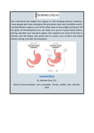 Lap Band Surgery by Top Rated Surgeons in Florida  Drmichaelchoi