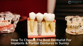 How To Choose The Best Denturist For Implants & Partial Dentures In Surrey