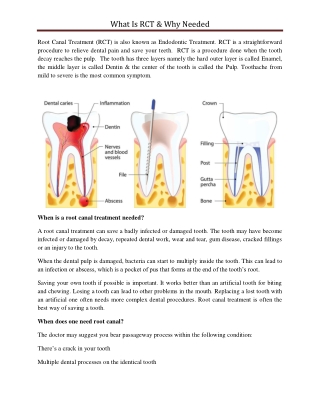 What Is RCT & Why Needed