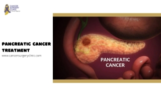 Surgery For Pancreatic Cancer By Dr Ganesh Nagarajan