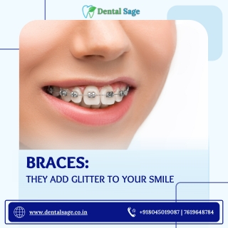 Dental Braces | Best Dental Clinic in Yelahanka | Dental Sage