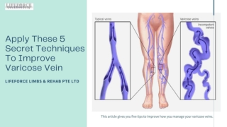 Apply These 5 Secret Techniques To Improve Varicose Vein