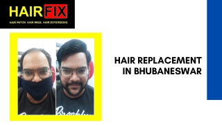 Hair Replacement in Bhubaneswar