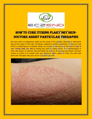 How to Cure Itching Flaky Dry Skin- Doctors Assist Particular Therapies