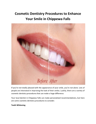 Cosmetic Dentistry Procedures to Enhance Your Smile in Chippewa Falls