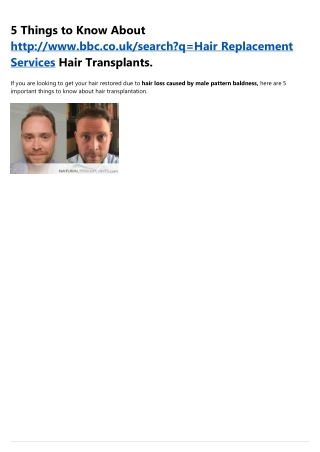 Hair Restoration Prices