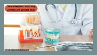 Dental Implant - How Long Will It Last if You Get One