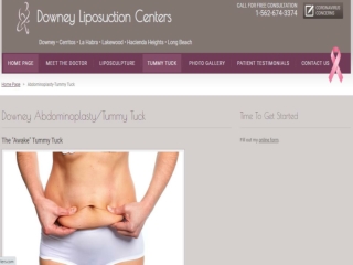Downey Liposuction