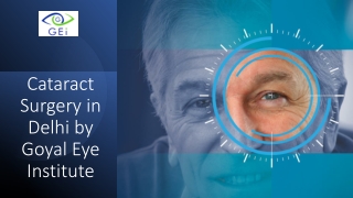 Cataract Surgery in Delhi by Goyal Eye Institute