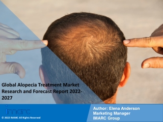 Alopecia Treatment Market PDF: Research Report, Share, Size, Trends, Forecast