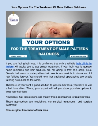 Your Options For The Treatment Of Male Pattern Baldness