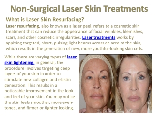 Non-Surgical Laser Skin Treatments