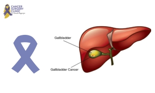 Surgeon Doctor For Gallbladder Cancer Treatment