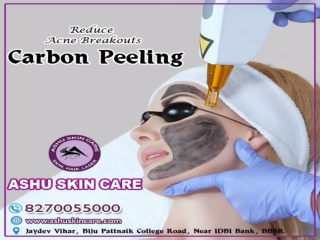ashu skin care is one of the best carbon laser peeling treatment clinic in bhubaneswar, odisha