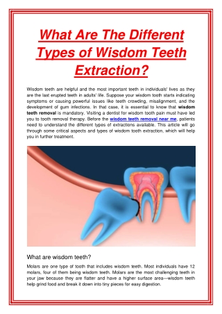 What Are The Different Types of Wisdom Teeth Extraction