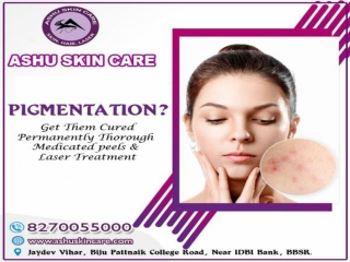 ashu skin care is one of the best for pigmentation remove  treatment clinic in bhubaneswar, odisha