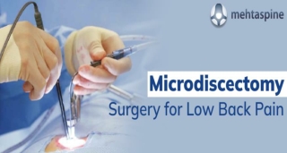 Microdiscectomy Surgery for Low Back Pain