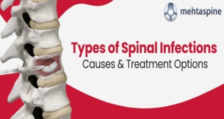 How Serious an Infection in the Spine can be? | Mehta Spine