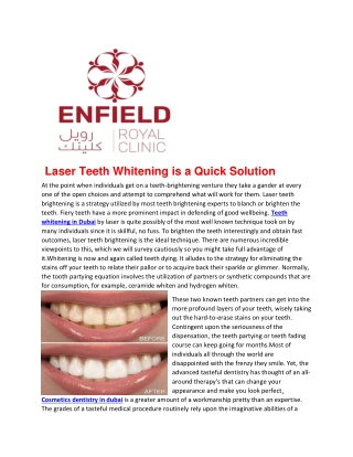 teeth whitening in Dubai 2