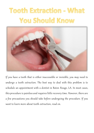 Tooth Extraction - What You Should Know