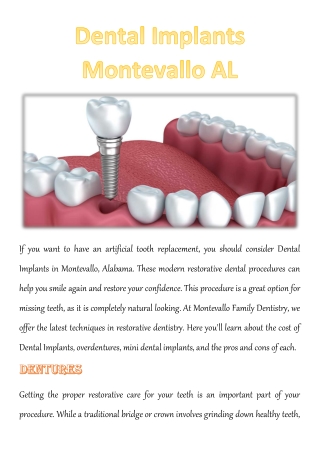 Dental Implants Montevallo AL