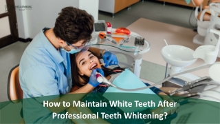 How To Maintain White Teeth After Professional Teeth Whitening