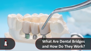 Dental Bridges: What Are They and How Do They Work?