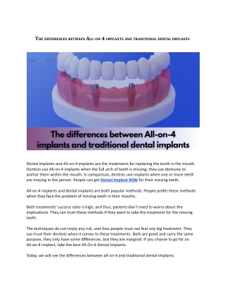 The differences between All-on-4 implants and traditional dental implants