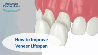 How to Improve Veneers Lifespan