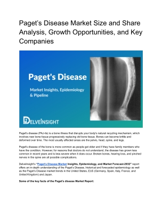 Paget’s Disease Market Insights and Epidemiology Forecast