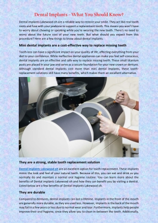 Dental Implants - What You Should Know?