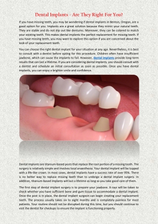 Dental Implants - Are They Right For You?