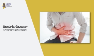 Treatments Of Gastric Cancer By Dr. Ganesh Nagarajan