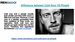 Difference between Cold Sore VS Pimple