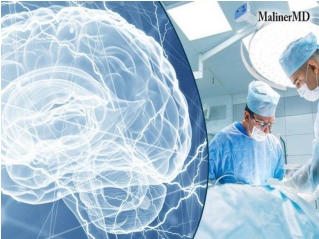 Brain Surgery Doctor in Florida