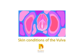 Skin conditions of the Vulva | Pregnancy Skin Conditions