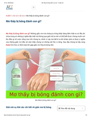 Mơ thấy bị bỏng đánh con gì_ - Kubet Ab