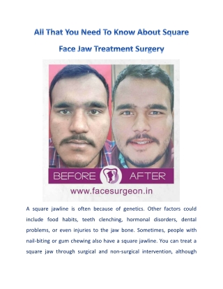 Square Face Jaw Treatment Surgery in India: 3 Things You Must Know