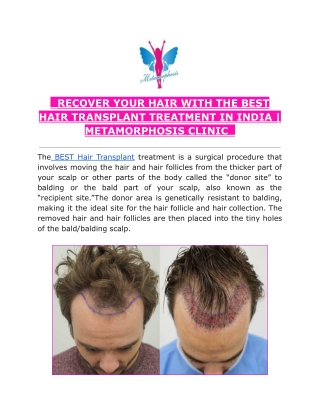 RECOVER YOUR HAIR WITH THE GREATEST HAIR TRANSPLANT IN INDIA | METAMORPHOSIS CLI