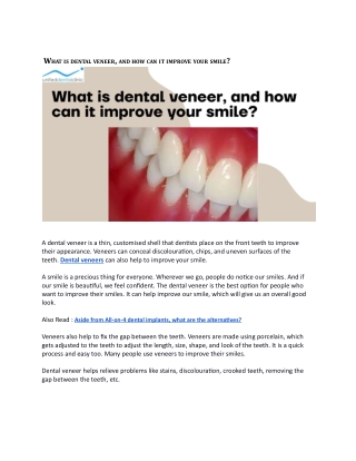 What is dental veneer, and how can it improve your smile