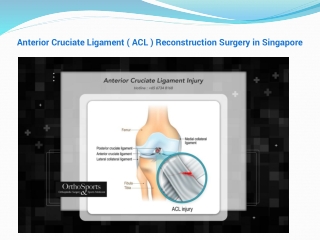 Ligament Reconstruction Surgery in Singapore