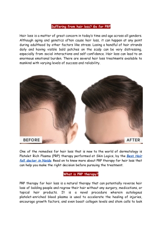 Suffering from hair loss? Go for PRP