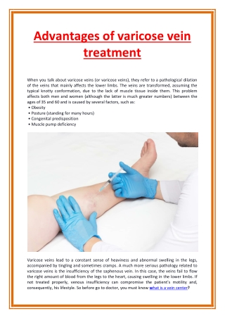 Advantages of varicose vein treatment